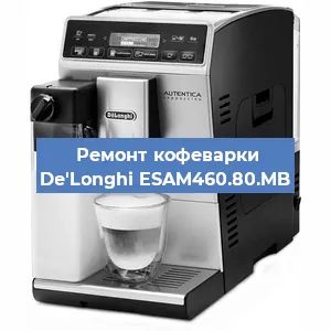 Ремонт помпы (насоса) на кофемашине De'Longhi ESAM460.80.MB в Екатеринбурге